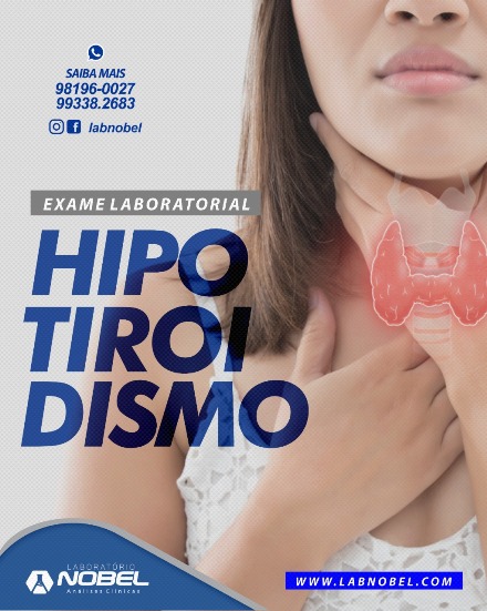 Hipotireoidismo 